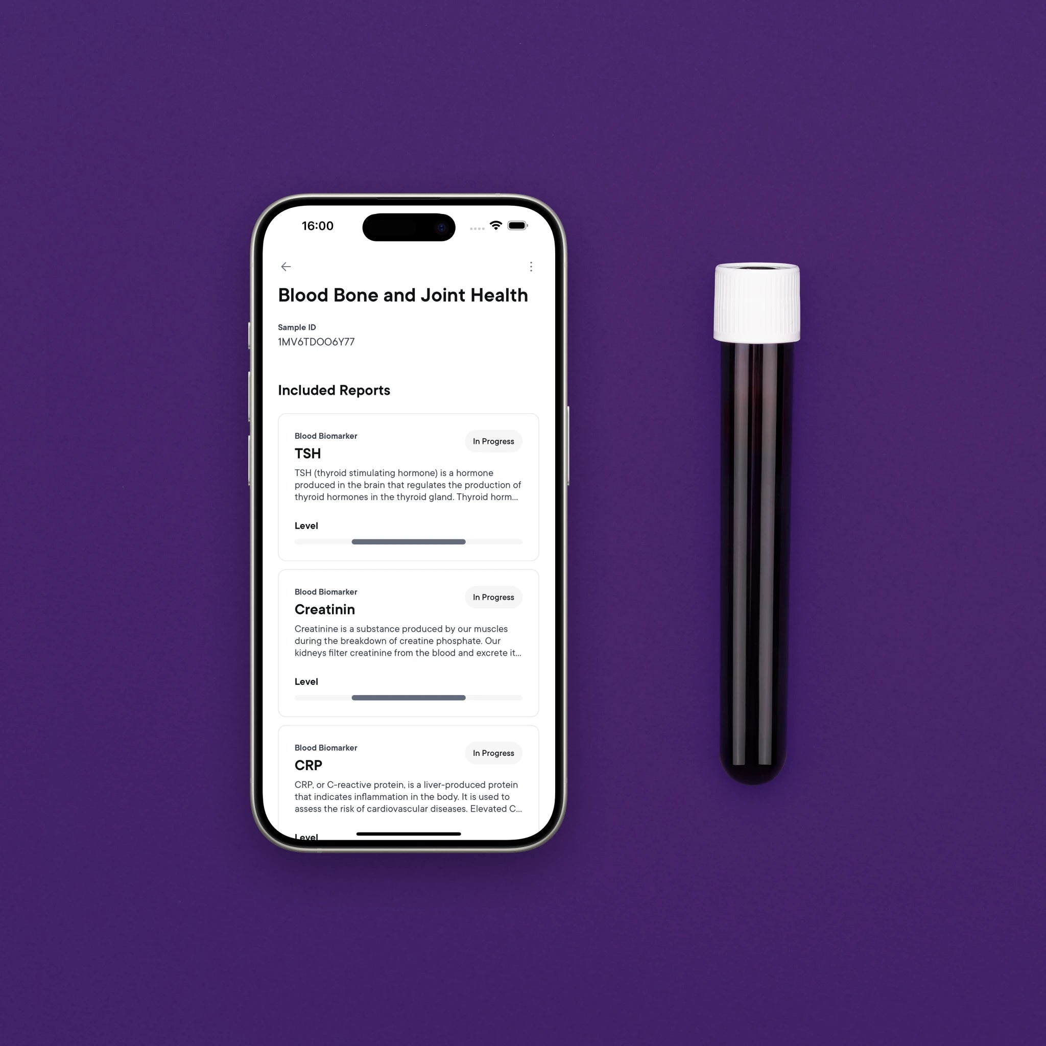 Badanie krwi: kości i stawy