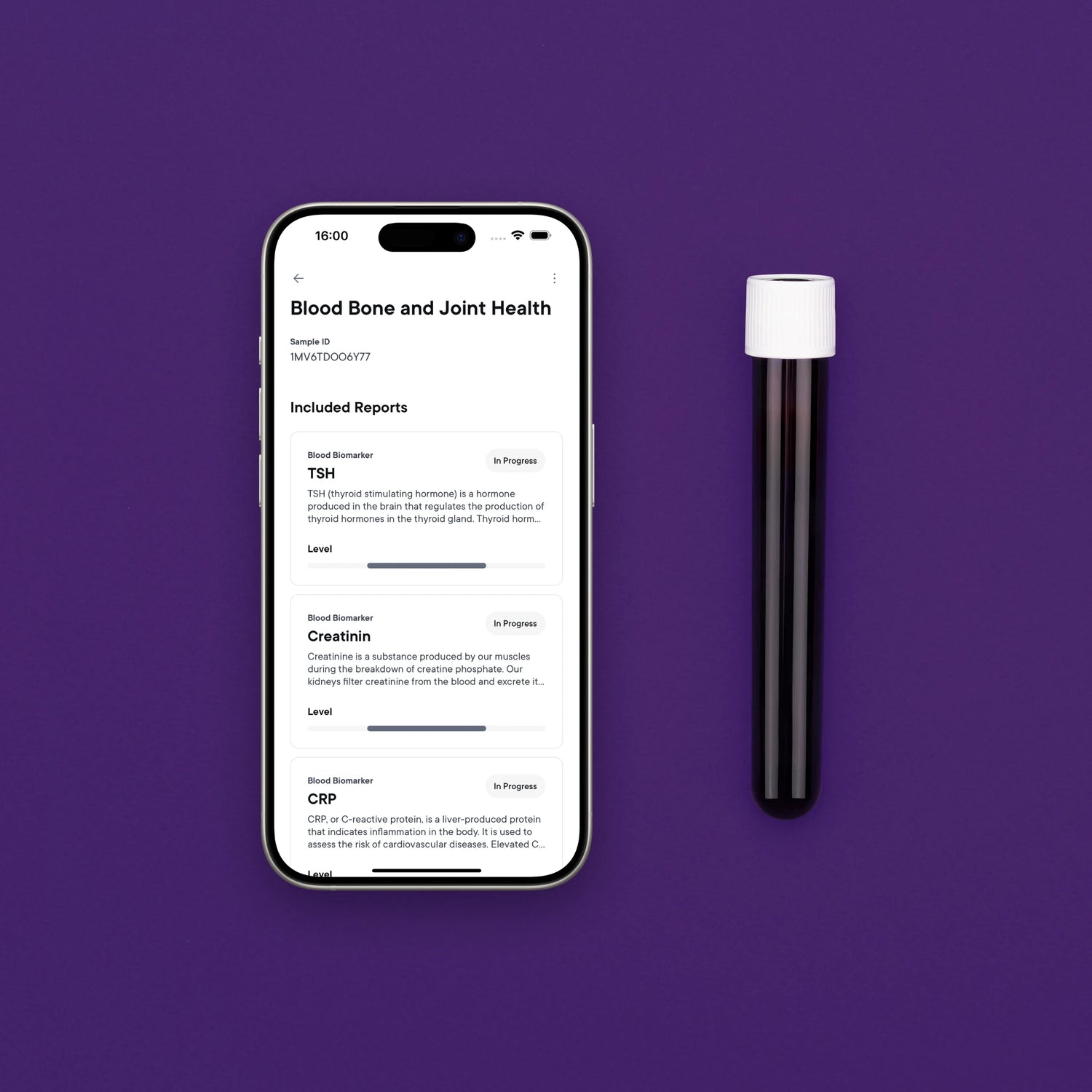 Badanie krwi: kości i stawy