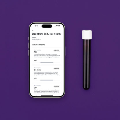 Badanie krwi: kości i stawy