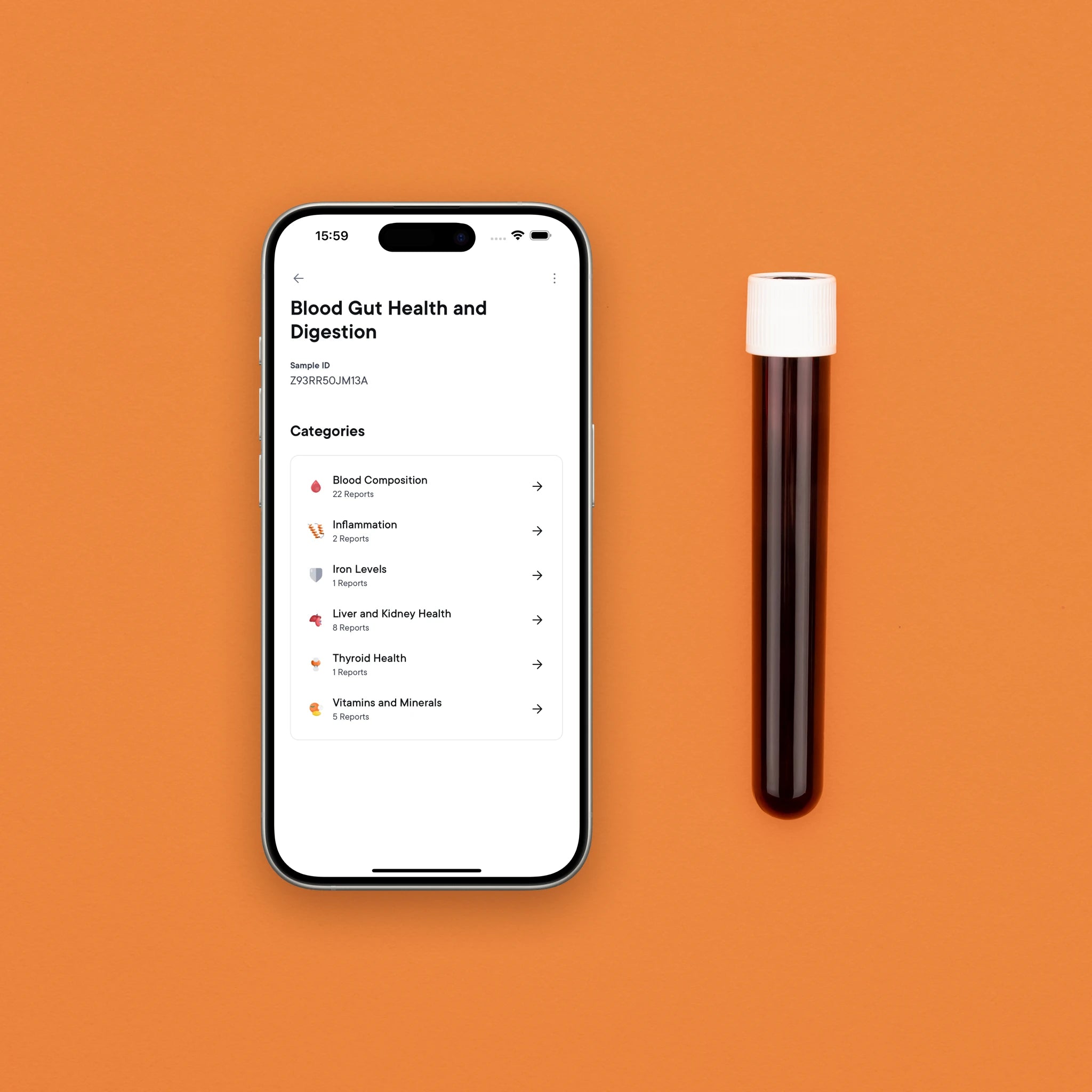 Badanie krwi: układ trawienny